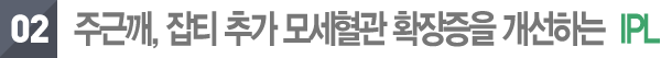 3D 프락셔널 타이트닝